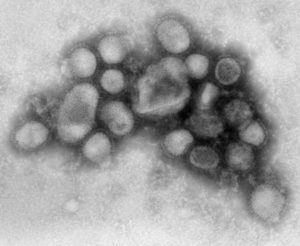 Spanish FluVirus