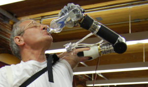 Thought controlled prosthetics